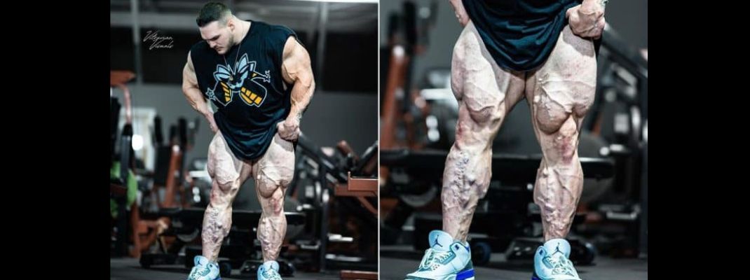 Nick Walker posta atualização impressionante e assusta com a quantidade de veias nas pernas, é algo para se preocupar?